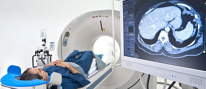 Abnormal magnetic-resonance scans