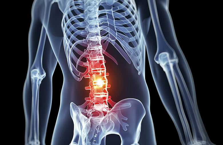 back pain