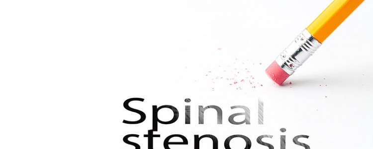 spinal stenosis