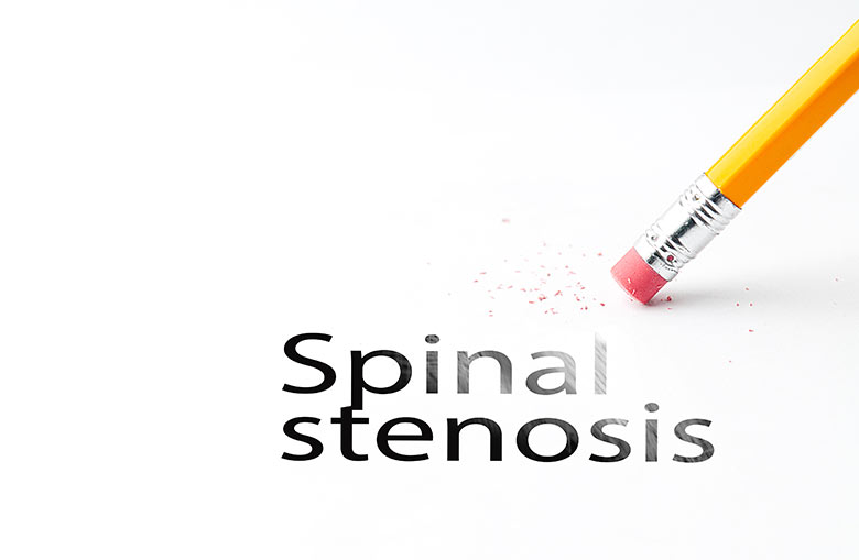 spinal stenosis